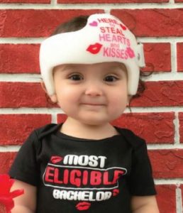 answers about plagiocephaly