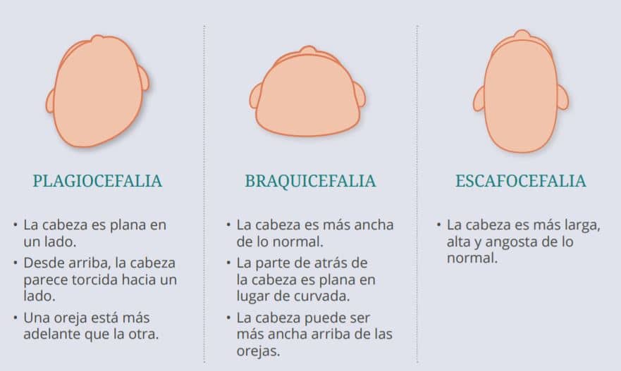 types of skull deformities