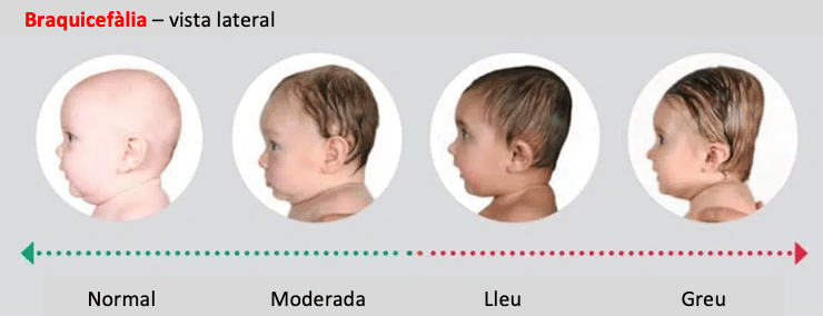 braquicefàlia vista lateral